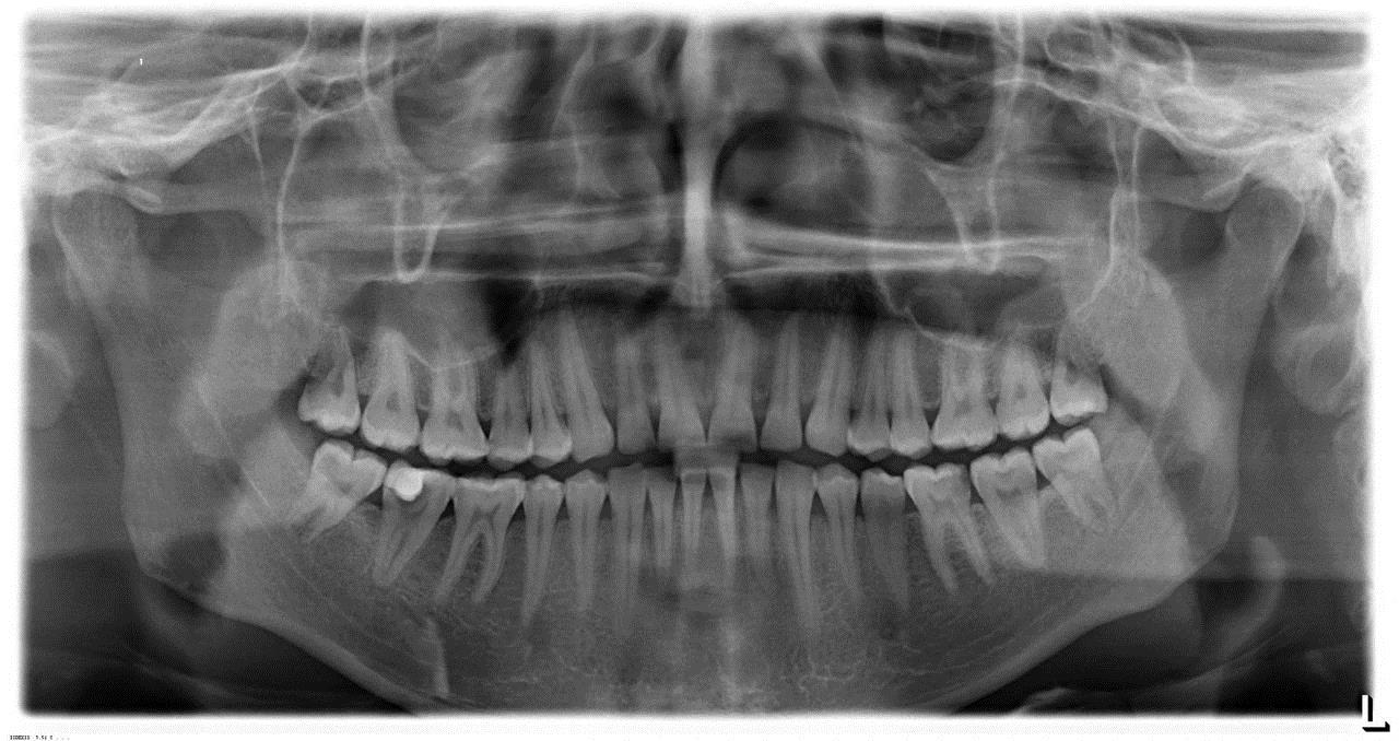 Рентген челюсти фото