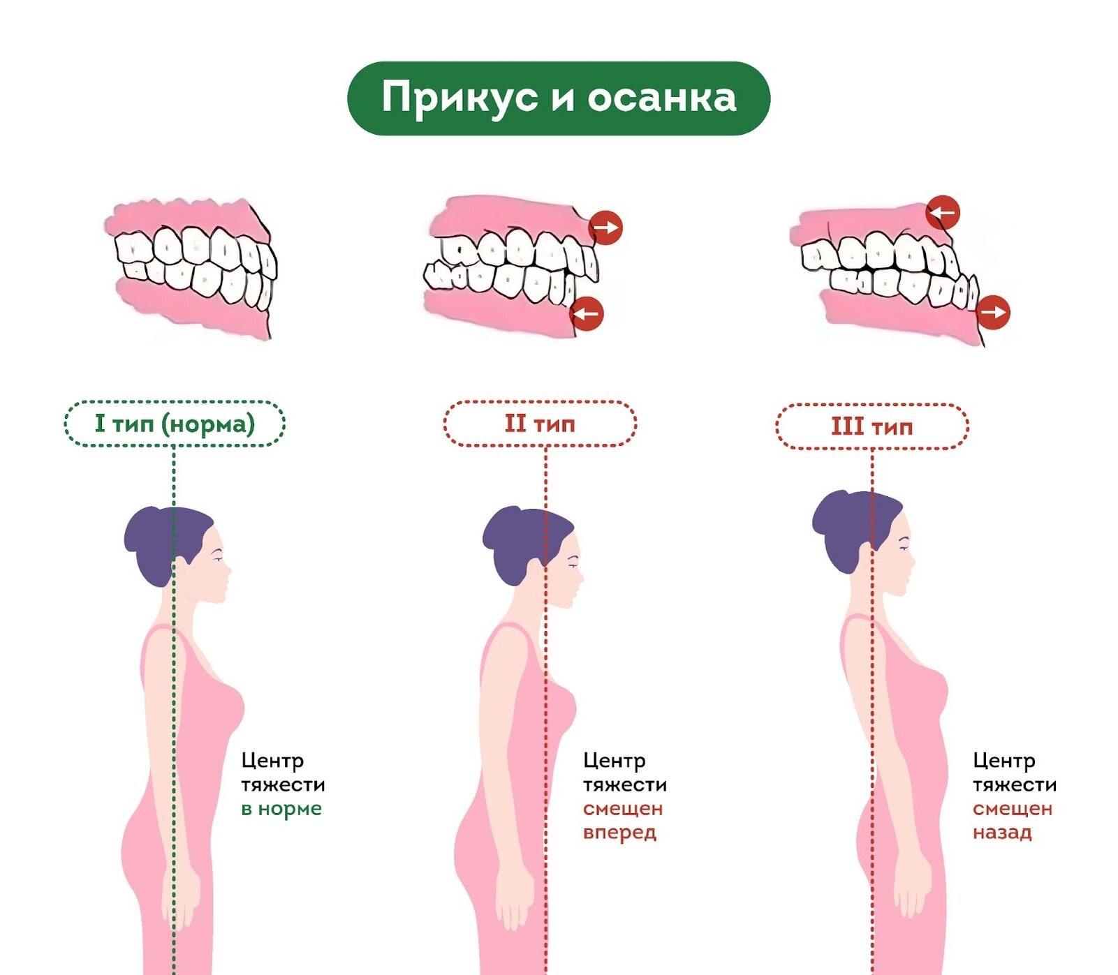 как прикус влияет на осанку