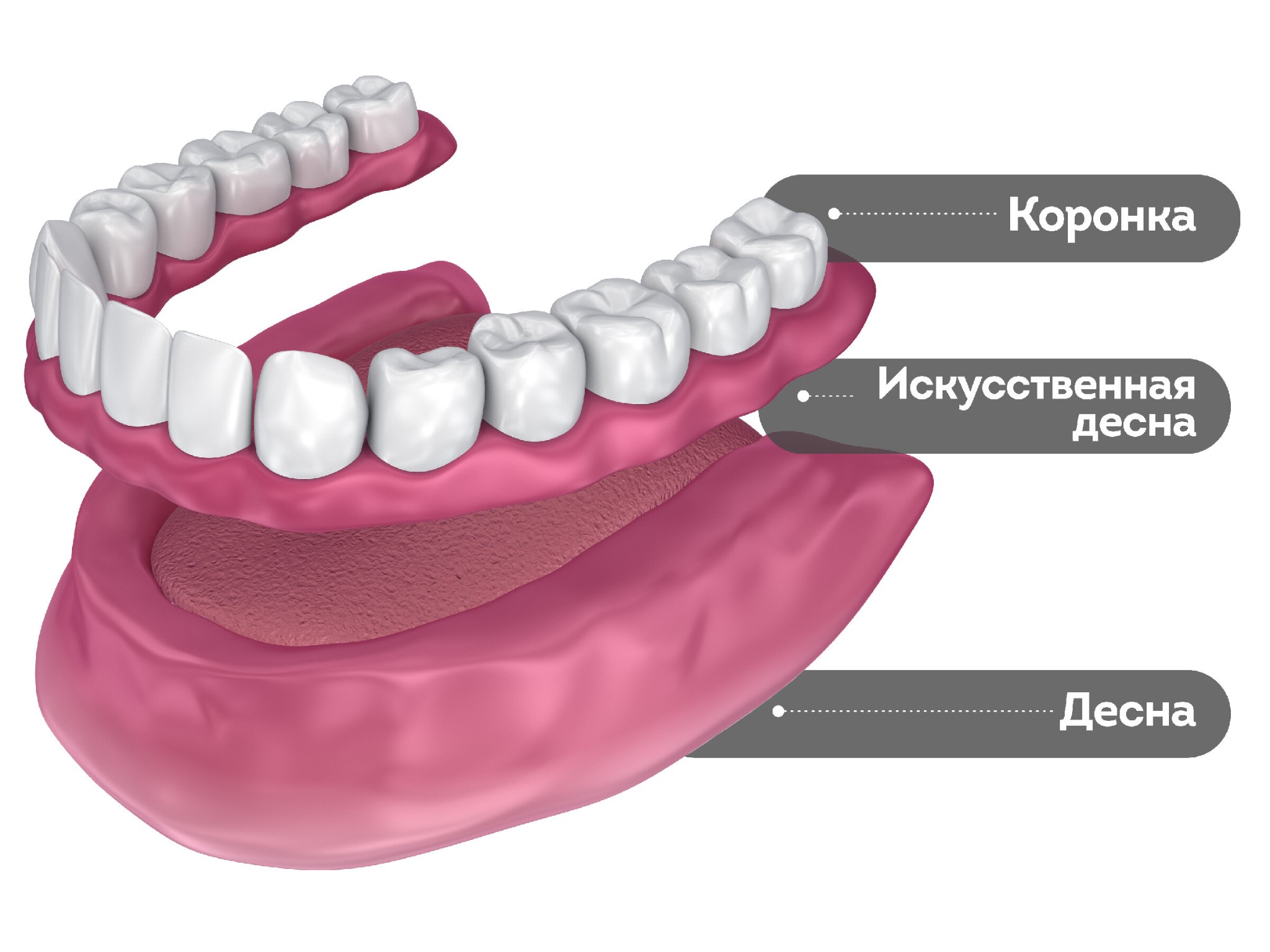 полные съемные протезы