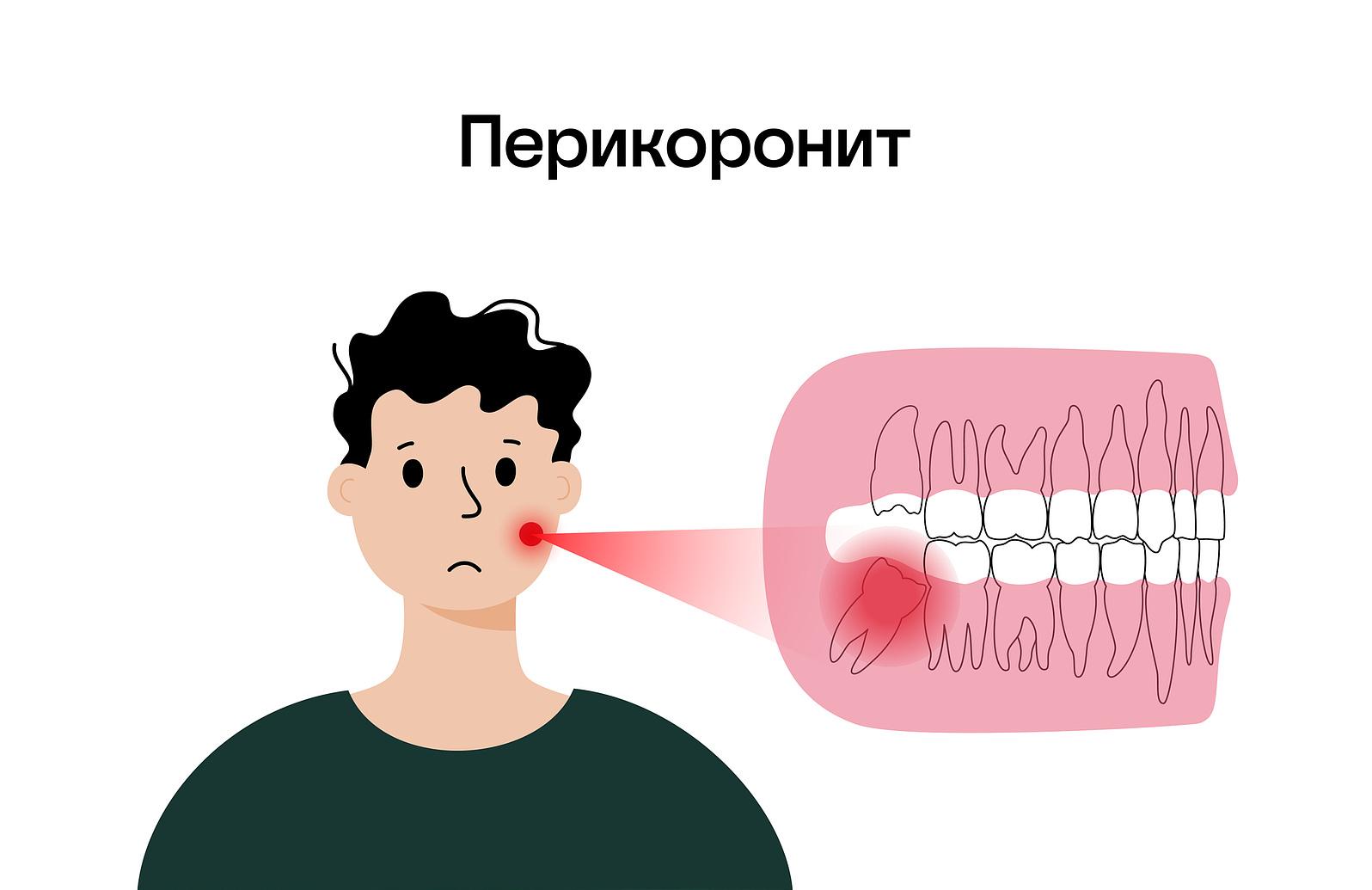 Аномальное расположение восьмерки в альвеоле