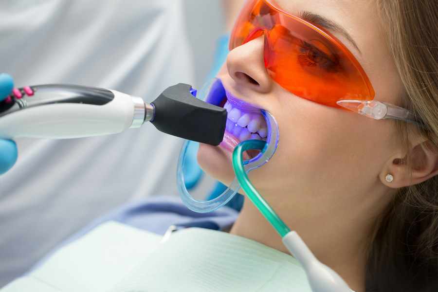 Желтые зубы - причины возникновения и способы лечения - советы стоматолога